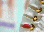 spinal disc pain