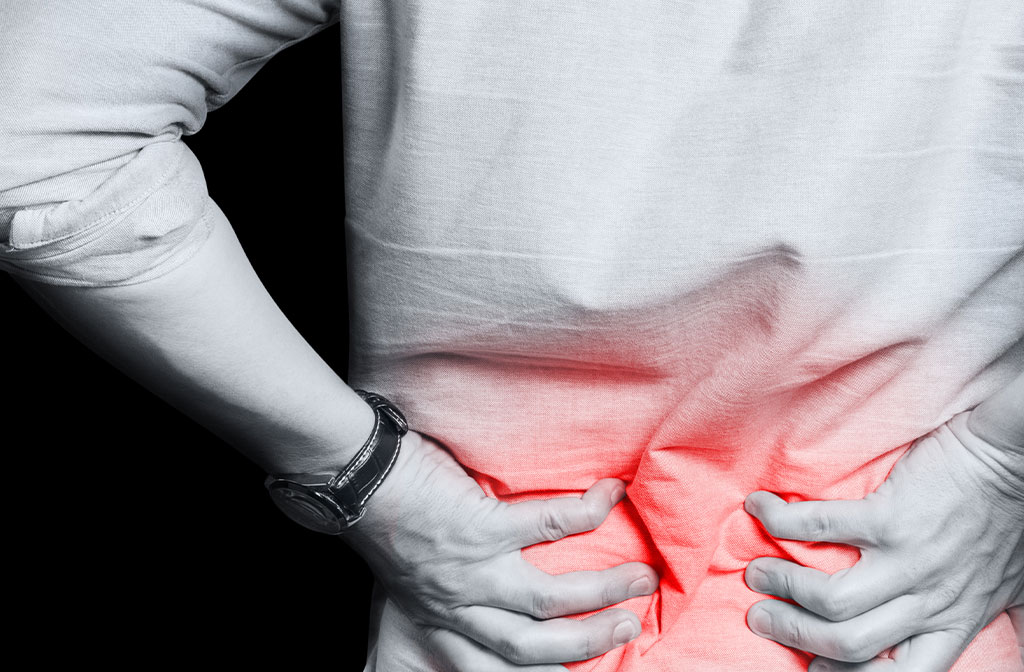 Everything You Need to Know About Sciatica